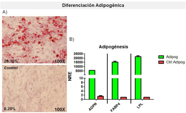 Figura 15. Diferenciación adipogénica de las células aisladas de MO humana. A) Imágenes de la tinción con Oil Red O  de  las  células  estimuladas  con  medio  adipogénico  y  de  las  células  control,  crecidas  en  DMEM20%