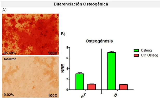 Figura  16.  Diferenciación  osteogénica  de  las  células  aisladas  de  MO  humana.  A)  Imágenes  de  la  tinción  con  Rojo  Alizarina de las células estimuladas con medio osteogénico y de las células control, crecidas en DMEM20%