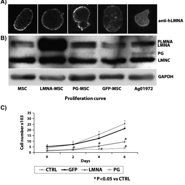 Figure 1. Characterization  of  mesenchymal  stem  cells  (MSCs)  transduced  with  progerin  (PG),  lamin  A  (LMNA)  or  green  fluorescent protein (GFP)