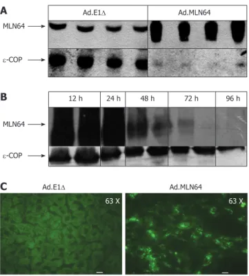 Figure	1  Effect of recombinant MLN64 adenovirus infection on MLN64 expression  in mice livers