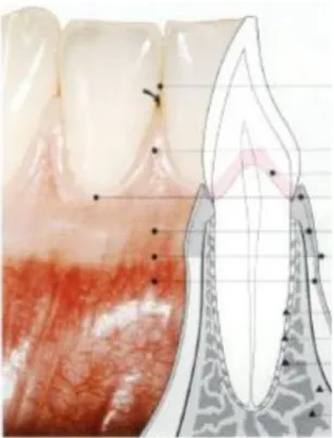 Ilustración 5 Espesos gingival de un incisivo inferior. Tomado de Atlas Of Periodontology 