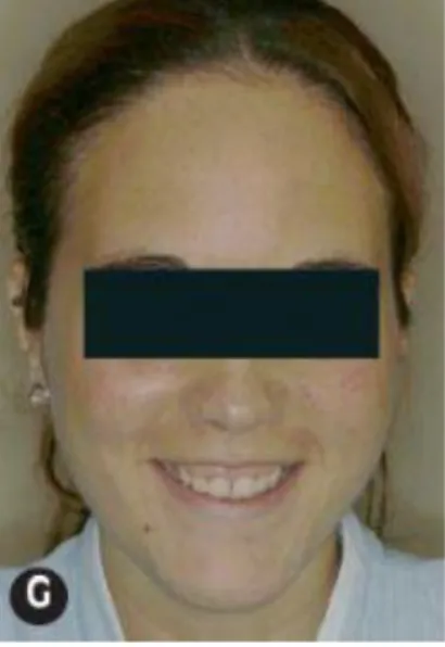 Figura N° 21: Vista frontal del paciente despues de realizada la cirugía  