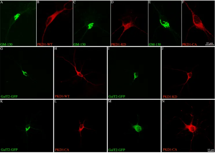Figure 2. A–F, Confocal images showing the morphology of the Golgi complex in neurons labeled with an antibody against the cis-Golgi marker GM-130 and transfected with GST-tagged PKD1-WT, -KD, or -CA