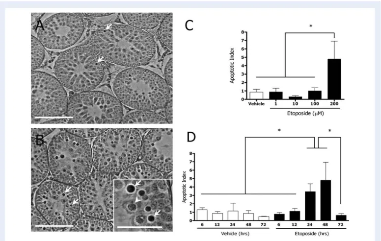 Figure 1 Etoposide induces apoptosis in rat spermatocytes.