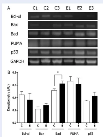 Figure 6 Levels of Bcl-2 related mRNA in etoposide-treated pub- pub-ertal rat testes.