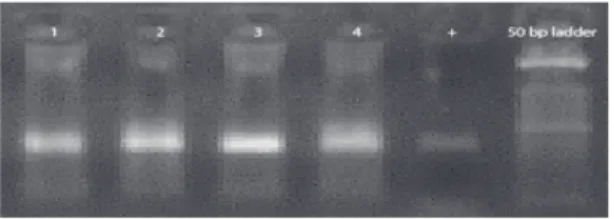 Fig. 4: Electrophoresis of RT-PCR products obtained from (1) Spleen; (2) Heart; (3) Lungs;
