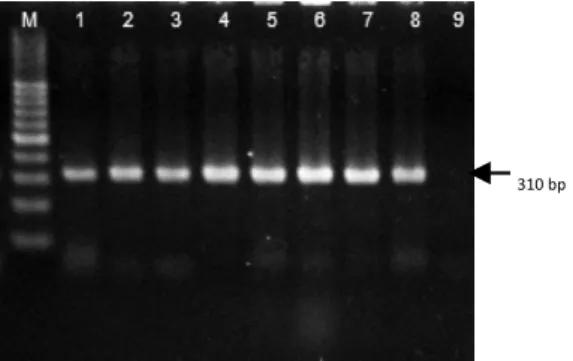 Figure  1.  PCr  products  of  Candida  albicans  identifica- identifica-tion. Agarose gel (2%), stained with ethidium-bromide