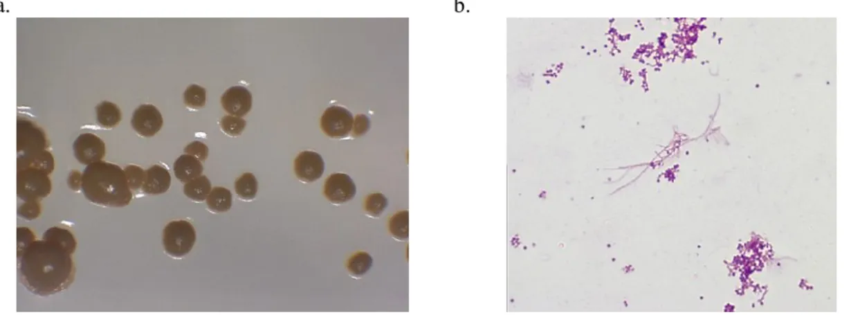 Figura 5:  Micromonospora sp. Crecimiento de la Colonia (a) microfotografía de la sp. (650x) (b) 
