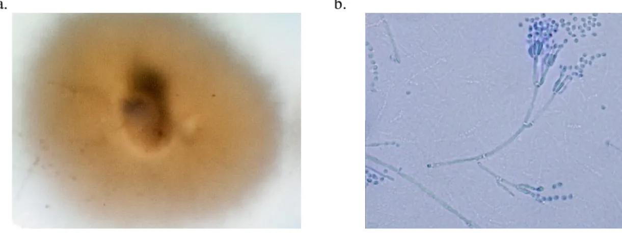 Figura 7: Penicillium janthinellum. Crecimiento de la Colonia (a) microfotografía de la sp