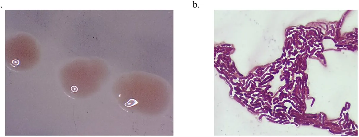 Figura 9: Achromobacter denitrificans. Crecimiento de la Colonia (a) microfotografía de la sp