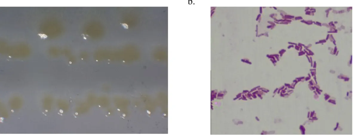 Figura 13: Paenibacillus tarimensis. Crecimiento de la Colonia (a) microfotografía de la sp.(1000x)  (b) 
