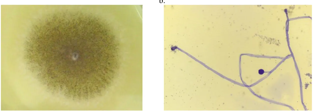 Figura 16: Mucor plumbeus. Crecimiento de la Colonia (a) microfotografía de la sp. (100x) (b) 