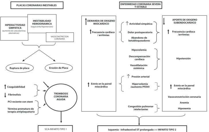 Figura 1: Mecanismos del infarto perioperatorio