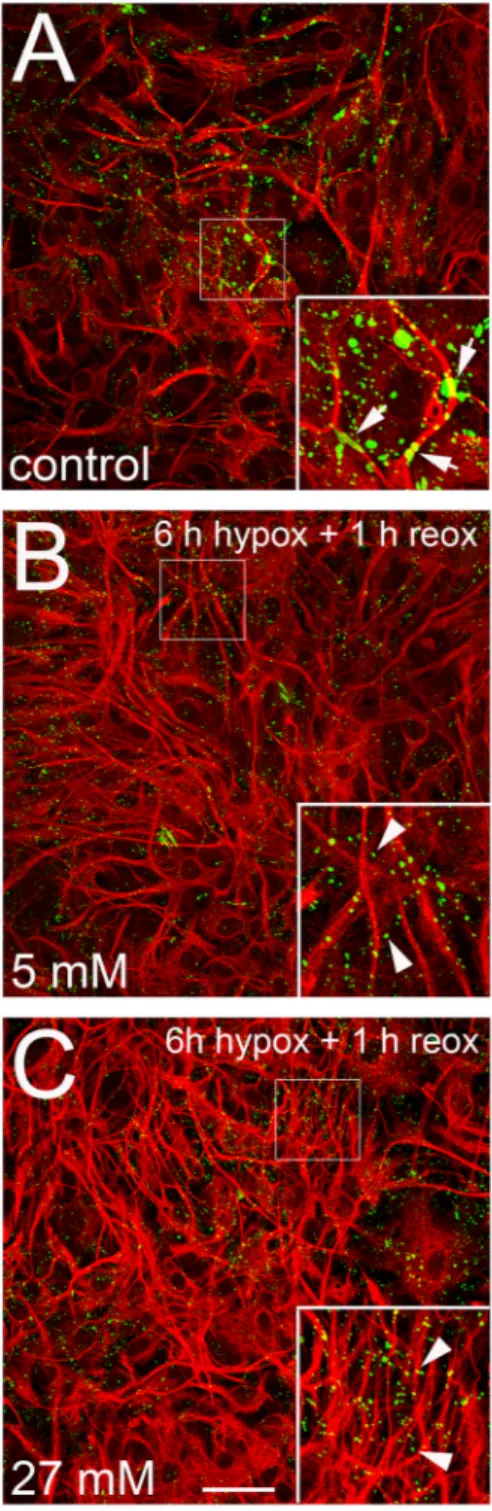 Figure 6. Hypoxia-reoxygenation causes disappearance of the larger Cx43 immunoreactive areas found in control cells and increases astroglial activation during reoxygenation