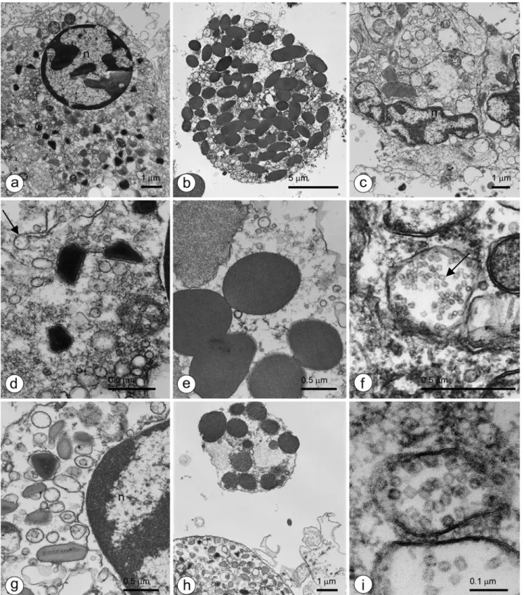 Fig. 3 Morphological characterization of Concholepas hemocytes isolated from hemolymph; transmission electron microscopy