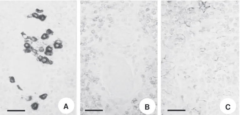 Figure 2: Human thymus showing C1 cells immunostained with monoclonal antibody 4F11 located around vascular structures (A).