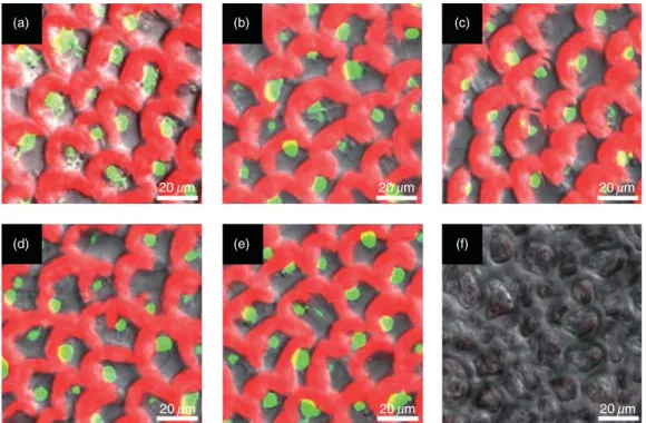 Figure 1. Visualization by confocal microscopy of cell viability in Ulva compressa cultivated in seawater without added copper (a), or with 5 mM (b), 10 mM (c), 25 mM (d), 50 mM (e) and 100 mM (f) of added copper for 7 d and then cultivated for 7 additiona