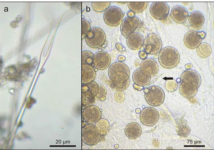 Figure 11. Faecal items of Laetmonice producta producta (st. PI5): (a) lyrate chaeta of a nephtyid polychaete, (b)  oocystes of gregarines (arrow showing crystals of unidentified mineral)