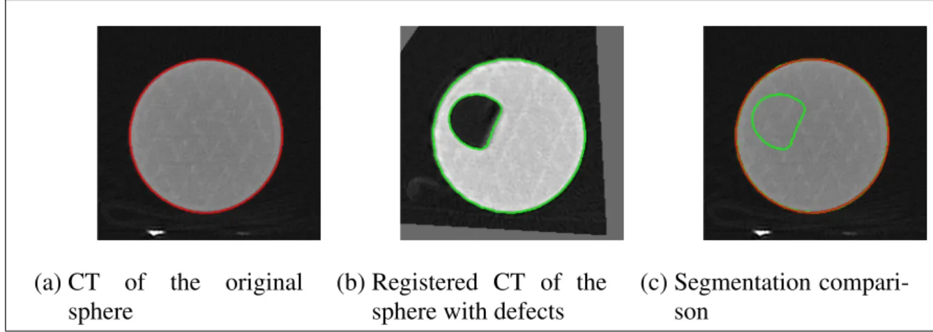 Figure 3.1 shows the result of the registration and the ACWE segmentation of the original sphere and the sphere with cylindrical defects