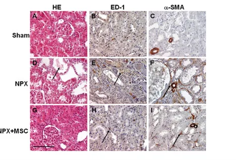 Figure 2 Histological NPX-induced damage in CKD kidneys