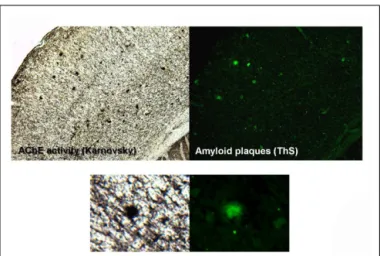 Figure 1). Moreover, AChE promotes A β 1–40 ﬁbril formation, in fact, AChE forms macromolecular complexes with the growing amyloid ﬁbrils, and is incorporated into senile-like plaques in vitro (Alvarez et al., 1997, 1998)