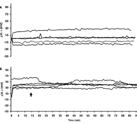 Fig. 3. Experiment 2. A: V L-S  of 5 control plants for 90 min. B: V L-S  of 5 plants in the  drought treatment from 15 to 90 min