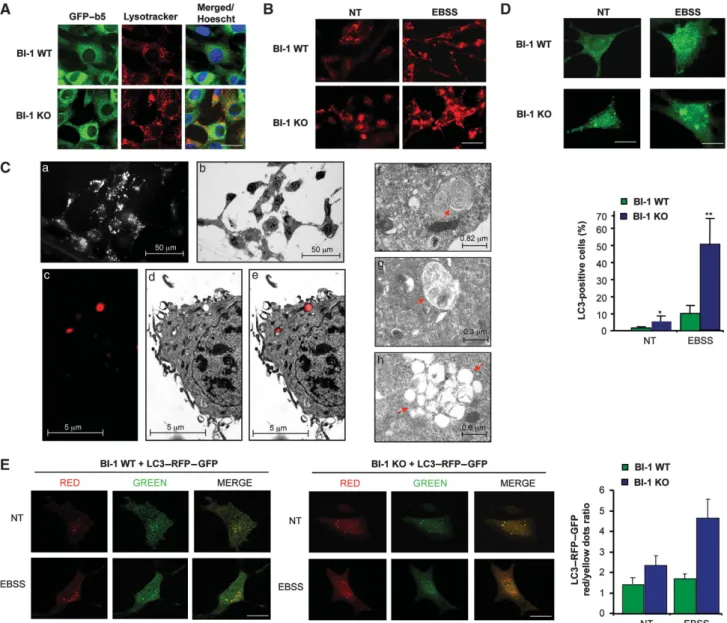 Figure 1 Increased accumulation of autophagosomes and lysosomes in BI-1-deficient cells