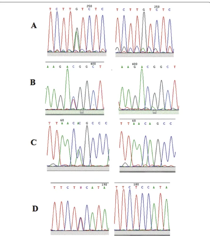 Figure 2 Novel variants detected within BMP4.1 promoter. A) c.-5514G > A. Left panel: sequence showing A/G change