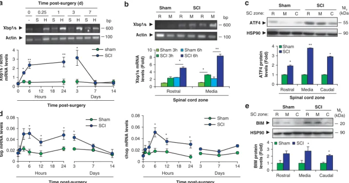 Figure 1 UPR activation after spinal cord hemisection. (a) Wild-type mice were spinal cord-hemisected (H) or sham-operated (S) at the T12 vertebral level