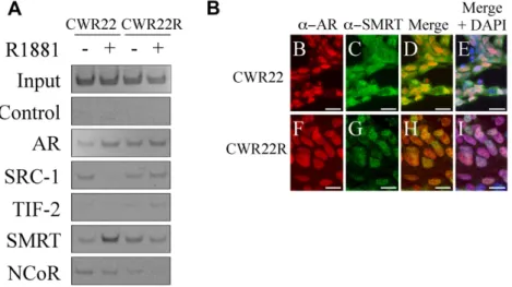 Fig. 4. Coregulator recruitment and colocalization to AR complex in CWR22 cells and CWR22R cells