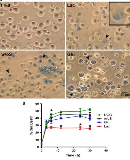 Fig. 1 The effect of metabolic energy sources on spermatocyte cell death. Spermatocytes were cultivated between 0 and 30 h in KHB-Lac, -Glu, -DOG or w/oS.