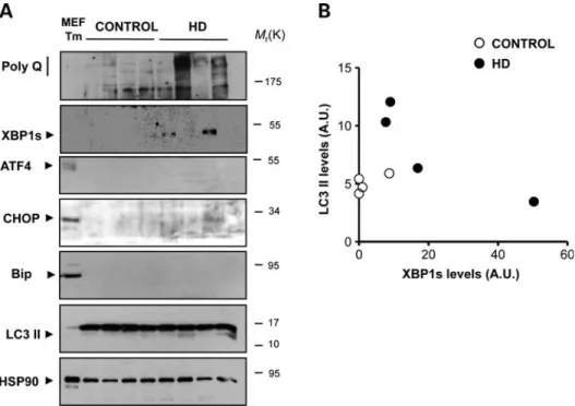 Figure 8. XBP1s, ER stress and autophagy markers in HD human post-mortem samples. (A) The levels of mHtt (anti-polyQ), XBP1s, ATF4, CHOP, BiP and LC3 were measured in total protein extracts derived from the striatum of post-mortem samples from HD patients 