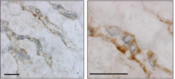 Fig. 2. Colocalization of calcium-sensing receptor and COX-2 in the TAL. Double label immunostaining of TAL segments for COX-2 (blue) and Calcium-sensing receptor (CaR) (brown); a similar protocol was used in our previous study [22]