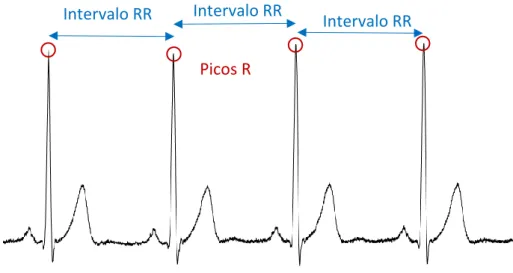 Figura 14. Representación de una serie de intervalos RR. En esta figura se pueden ver 4 latidos con sus  correspondientes intervalos.Pico R  Intervalo determinado ÁREA Picos R Intervalo RR Intervalo RR  Intervalo RR 