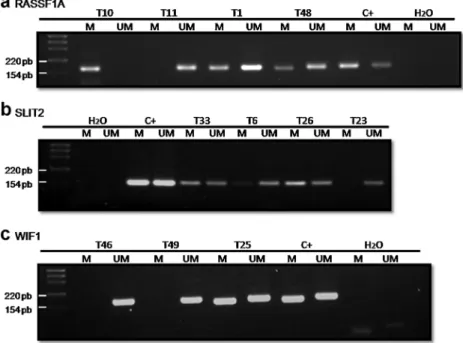 Figure 2. Products ampliﬁed by methylation speciﬁc PCR (MS-PCR) of (a) RASSF1A, (b) SLIT2, and (c) WIF1 promoter regions