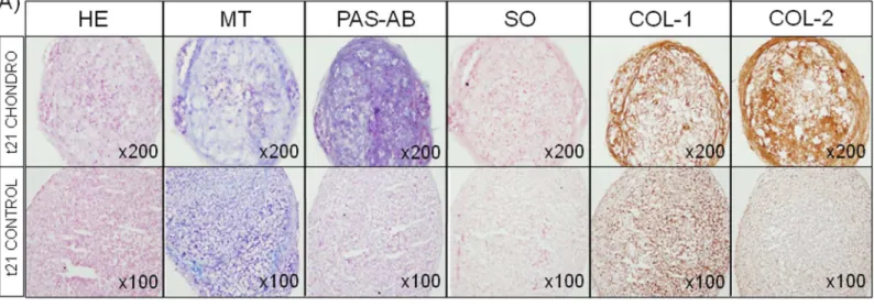 Fig 4. Chondrogenic differentiation of oBMSCs. (A) Ovine bone marrow mesenchymal stromal cells (oBMSCs, n = 3, passages 2 nd -5 th ) in micromass culture for 21 days in non-differentiation control medium (“t21 Control”; 20% FBS/DMEM) and chondrogenic-diffe