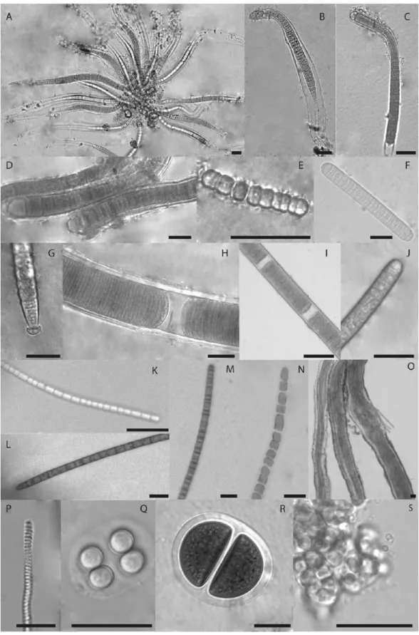 Fig. 1. Representative micrographs of epiphytic cyanobacteria on the phyllosphere of the seagrass Cymodocea rotundata: (A–E) heterocystous cyanobacteria (A) Calothrix with terminal cells (heterocysts), (B) a close-up of the filament in (A), (C, D) other Ca