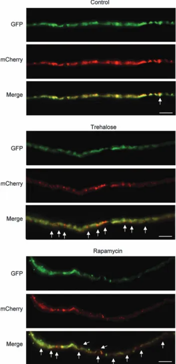 Figure 4 Pharmacological activation of autophagy in the peripheral nerves. Sciatic nerves were obtained from animals transduced with AAV2/2_mCherry-GFP-LC3 and treated with trehalose or rapamycin as described in Figure 2