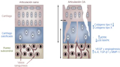 Figura	
   3:	
   Hueso	
   subcondral	
   en	
   la	
   artrosis.	
   La	
   figura	
   representa	
   la	
   influencia	
   del	
   hueso	
   subcondral	
   sobre	
   el	
   proceso	
   artrósico	
   y	
   su	
   interrelación	
   con	
   el	
   cartílag