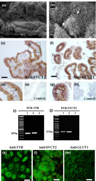 Fig. 1 Vitamin C transporter expression in bovine choroid plexus cells.