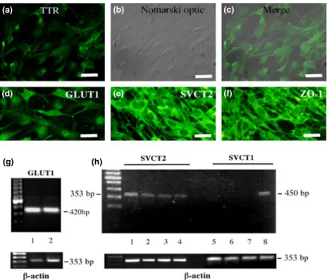 Fig. 3 Analysis of the expression of glucose transporters (GLUT)s and  sodium-vitamin C cotransporter (SVCT)s in primary cultures of human choroid plexus papilloma (HCPP)