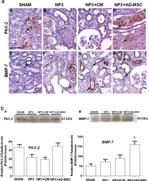 Figure 7 Immunolocalization and expression of epithelial markers in MSC-mediated recovery of CKD