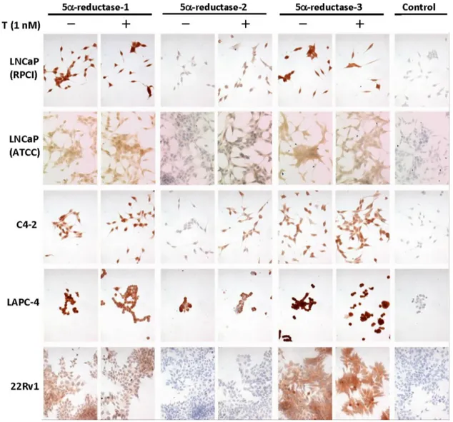 Fig. 1. IHC for 5 a-reductase-1, -2, and -3 in prostate cancer cells cultured in the presence or absence of1 nM testosterone (T).Note: the pink hue in row 2 was animage acquisition error thatdid not affect analysis and was not affectedby image processing.