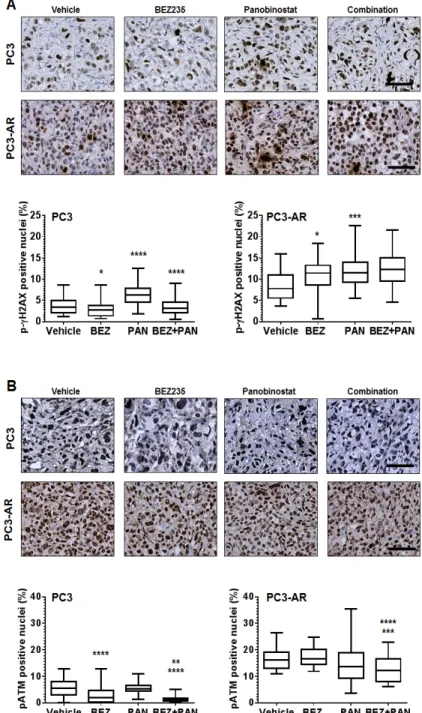 Figure  6:  (A)  Representative  photomicrographs  of  p-ɣH2AX  immunostained  PC3  and  PC3-AR  tumor  tissue