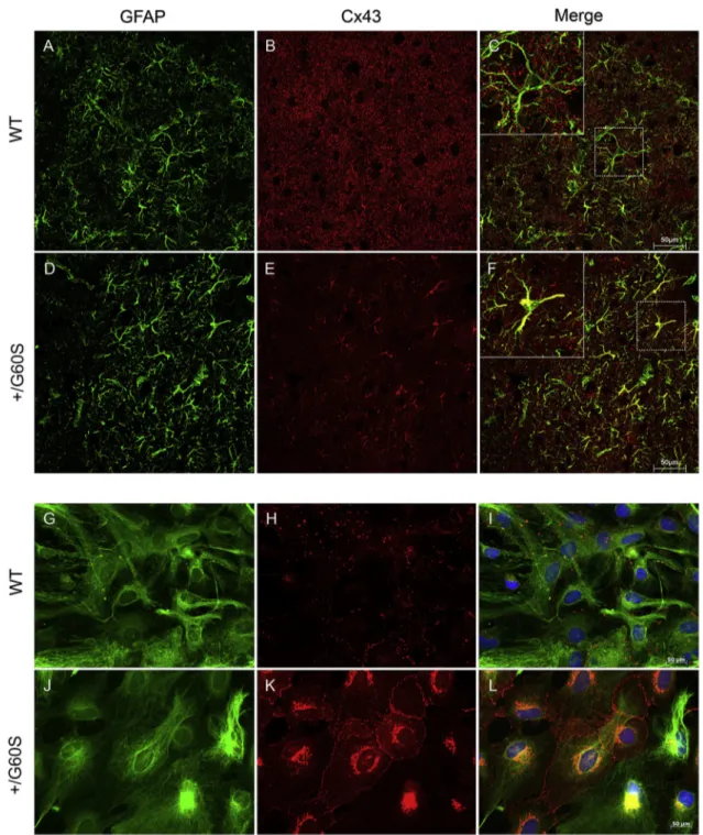 Fig. 3. Cx43 immunolocalization in wild-type and þ/G60S brain sections and cultured astrocytes