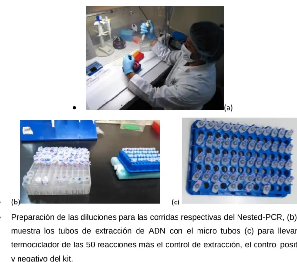 GRÁFICO 5.- Preparación de la solución Premix y enzima. 