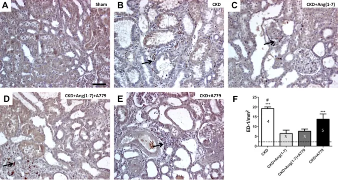 Figura  5.  Infiltración  por  macrófagos  ED-1.  Imágenes  representativas  de  los  diferentes  grupos con tinción con inmunohistoquímica para ED-1