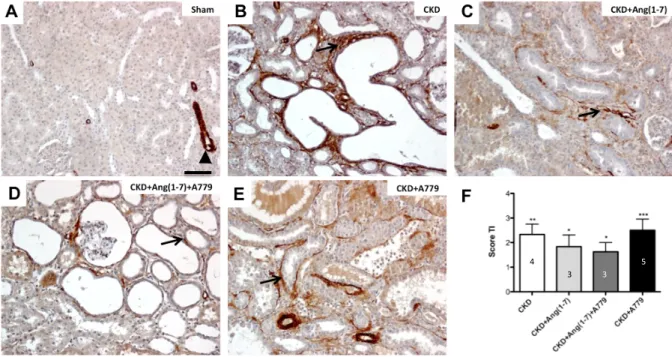 Figura  7.  Cortes  histológicos  de  riñón  de  los  grupos  tratados,  con  tinción  de  inmunohistoquímica  para  α-SMA