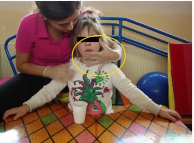 Figura 3.7: Toma de control de la mandíbula  del niño durante la estimulación. 