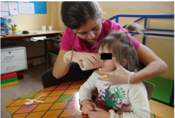 Figura 3.15: Facilitación de la deglución con  vaso. 